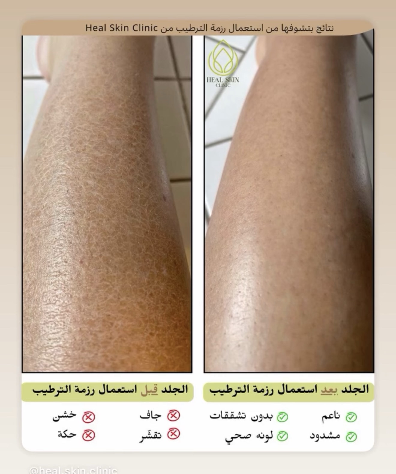 رزمة الترطيب العلاجية كاملة - الصورة 4