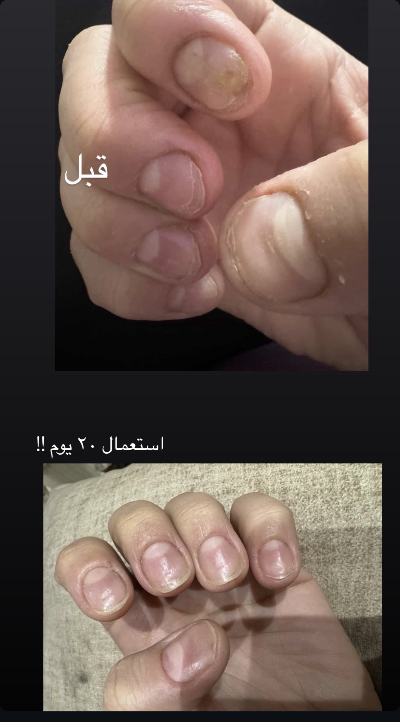سيروم الاظافر الطبيعي - الصورة 3