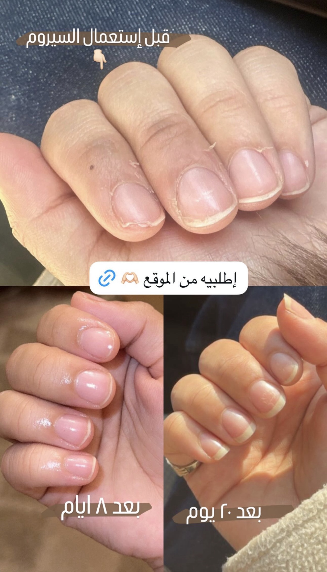 سيروم الاظافر الطبيعي - الصورة 2