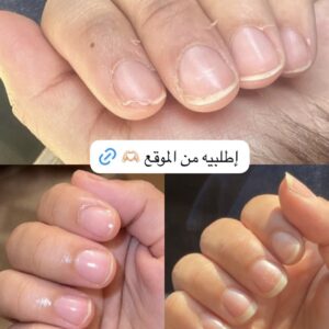 سيروم الاظافر x2